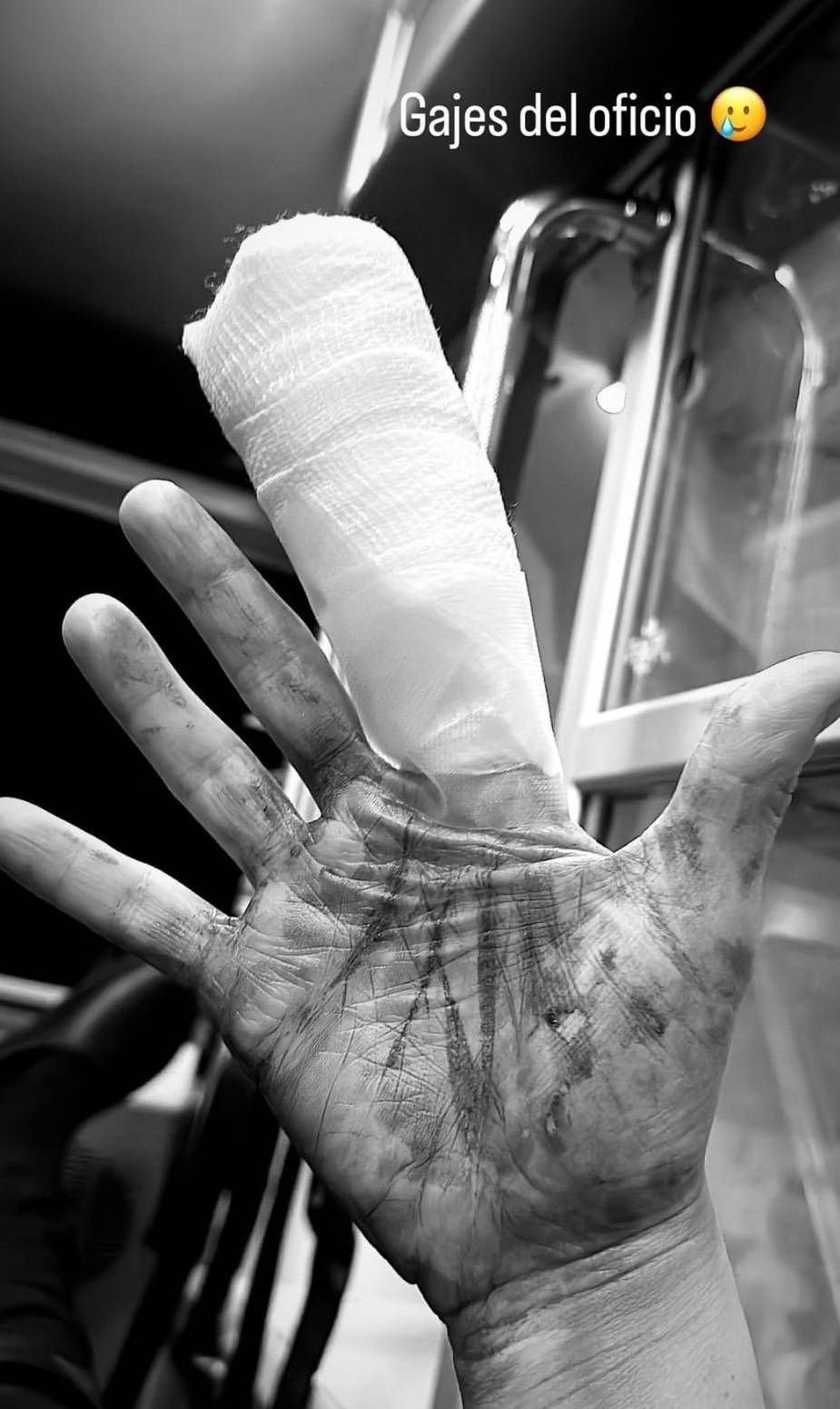 Gianella Marengo sufrió grave accidente en “Top Chef VIP” “Me faltaba